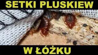 ZWALCZANIE PLUSKIEW JAK SIĘ POZBYĆ PLUSKIEW???