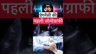 First sonography during pregnancy? First ultrasound in pregnancy in hindi | #shorts #Drgourirai