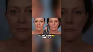 How Long Does The WeekendLift&trade; Procedure Take?
