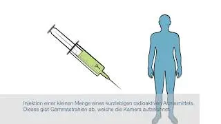 Nuklearmedizinische Untersuchung - Institut für Radiologie und Nuklearmedizin – Stadtspital Triemli