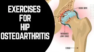 Exercises for hip osteoarthritis|Physical therapy for hips@PhysiotherapyTreatments