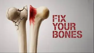 The 3 Supplements That Actually Help with Osteoporosis
