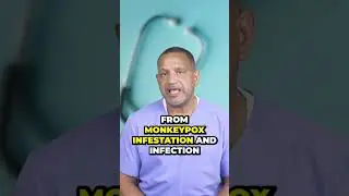 Monkeypox  The Deadly Disease You Didn't Know About