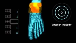 Foot Under X  Ray with other Elements   Royalty Free Footage