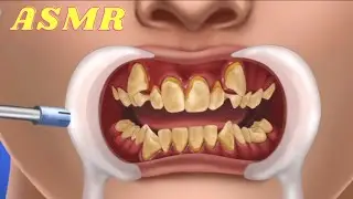 ASMR HOSPITAL GAMES | DENTAL CARE