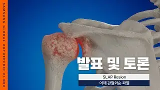[ SGOC 아카데미 ] 어깨불안정성 SLAP Lesion(슬랩병변) 치료방법 #대구정형외과 #어깨재활 #대구어깨병원 #대구어깨통증