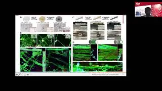 Tissue Engineering and Nanomedicine for Replacement and Treatment of Diseased Tissues and Organs