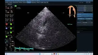IQ 401 AUTOEF ECHOCARDIOGRAPHY ECHOPAC ANALYSIS AFI LV:LA:RV AUTOEF PAPS  FS  SMALL ANIMAL