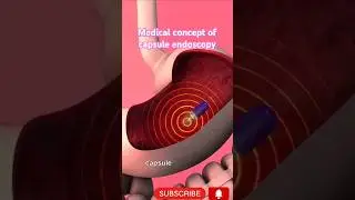 Medical concept of capsule endoscopy #anatomy  #anatomy #doctor