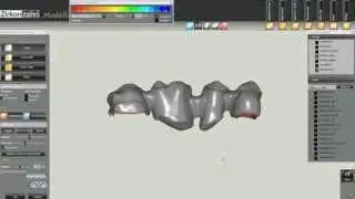Pr&oacute;tese fixa - 4 elementos - Sistema CAD CAM - In Lab - Software - Zirkonzahn - Talladium do Brasil