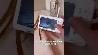 Dual Camera Baby Monitor with Split-Screen & No WiFi Needed!