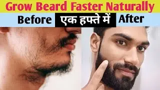 How to grow Beard faster Naturally | Beard Kaise Grow Kare