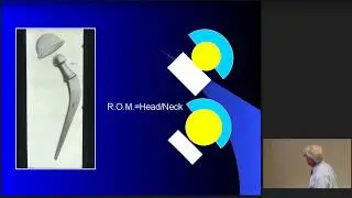 History of the Total Hip by Dr. Dunn