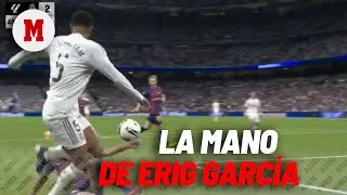 Alfonso P&eacute;rez Burrull sobre la mano de Eric: 