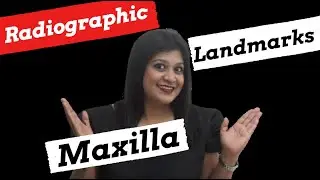 MAXILLARY LANDMARKS IN RADIOLOGY| DENTISTRYBYPRATS