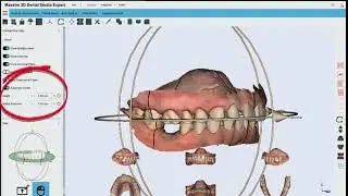Maestro 3D | Dental Studio Expert | Come eseguire l'estrusione radiale nei modelli?