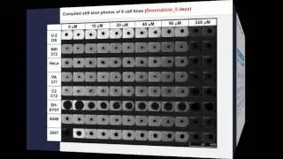 Monitoring the effects of DXR on 3D-spheroid tumor cells Video Abstract 112566