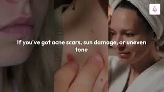 From Scars to Glow! Chemical Peel Results in Grapevine & Southlake, TX