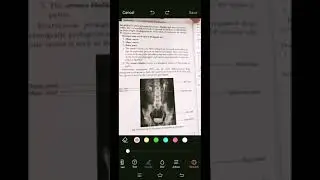 Intravenous Pyelography(hindi)