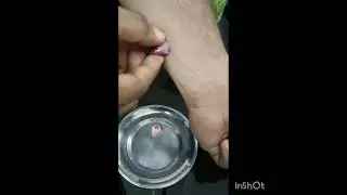 Natural Remedy for Ring Worm Infection