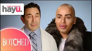 Jordan Is Addicted To Filler | Season 2 | Botched