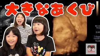 【出産記録】お腹の中で大きなあくびをする赤ちゃん！めっちゃかわいい❤︎れのれらTV【#1029】
