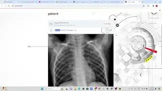Disease Detection Model | Alzheimer's Disease | Lung Cancer | Pneumonia. Medical Image Analysis.