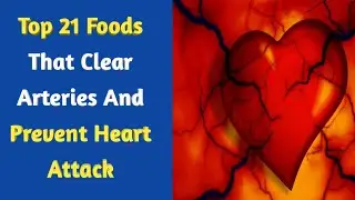 Top 21 Foods That Naturally Clear Arteries & Prevent Heart Attack