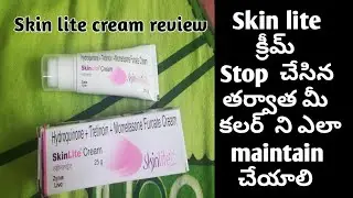 ||🤷🏻&zwj;♀️Skin lite క్రీమ్ Stop చేసిన తర్వాత మీ కలర్  ని ఎలా maintain చేయాలి 🤷🏻&zwj;♀️||