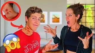 HICKEY PRANK ON MOM! (bad idea)
