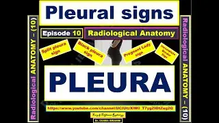 Anatomy 10, Pleural signs (Pregnant lady sign, Split sign, Black sign & incomplete border sign)
