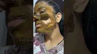 Easy D-Tan Pack At Home | Get Fair & Clear Skin | Remove Tanning #dtan #dtanpack #fairskin #ytshorts
