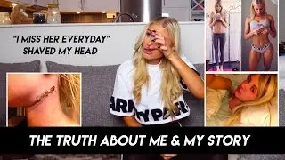 THE TRUTH ABOUT ME. MY STORY WITH CANCER & BEING SKINNY. - VLOG3