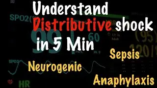 Distributive Shock: The Most Confusing Type of Shock Explained