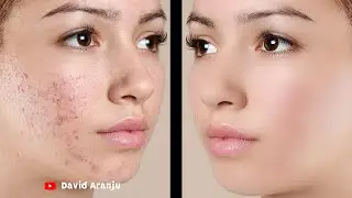 High-End Skin Retouching on Smart Phone || Phone Tutorial