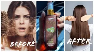 WOW Skin Science 100% Pure Castor Oil - Cold Pressed - For Stronger Hair, Skin & Nails