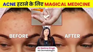 Isotretinoin (Accutane) for Acne Treatment | Benefits, Side Effects & Myths | Dermatologist Explains