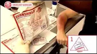 Burnshield Retail