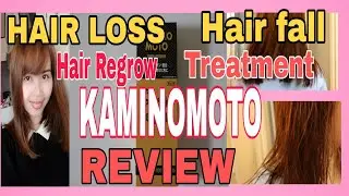 KAMINOMOTO REVIEW―HAIR FALL HAIR LOSS TREATMENT REVIEW!