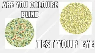 Colour  blind test eye problem eye test eye sight eye doctor 2020