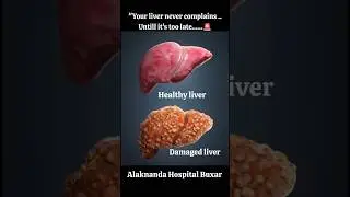 &ldquo;Love your liver! Avoid alcohol, junk food, and self-medication. Regular checkups can save your life