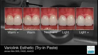 Dental Aesthetic Ceramic Selection