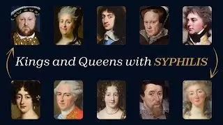 50 Kings and Queens With Syphilis That Will Shock Your Mind | For Sleep