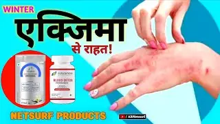 सर्दियों में ECZEMA से राहत Netsurf Products से |  Eczema Care in Winter ❄️| Skin Care With Netsurf