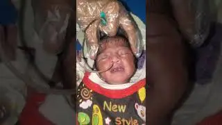 Newborn Baby Suction Process &ndash; Clearing Mouth and Nose to Protect Lungs