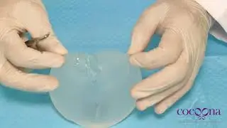 Art of Aesthetic Surgery by Dr. Sanjay Parashar Step by step tutorial of cosmetic surgery procedures