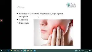 Manejo de Parestesia