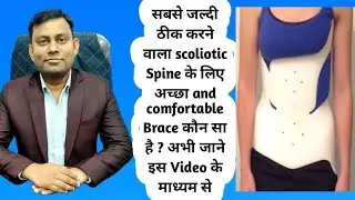 Boston Brace Orthotic Management  For Scoliotic Spine || Bornlife Artificial Limbs Center