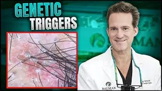 The SHOCKING Truth Behind Hair Loss
