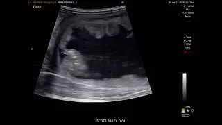 Equine Fetal Sexing - SA2 Ultrasound and eCLi6 Transducer #7